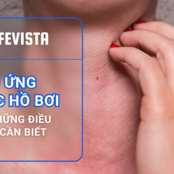 Dị ứng nước hồ bơi