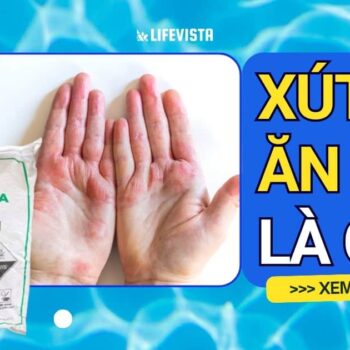 xút ăn da là gì